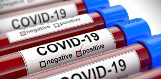 Jean Danhong Chen on Easing the Fear for Immigrants to get COVID-19 Testing