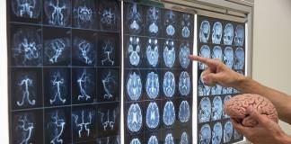 One Person Infected With Rare Brain-Eating Amoeba in Florida; Authorities Issue Warnings