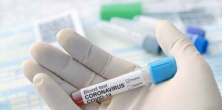 147 COVID-19 Infections, 3 Deaths, and Jail Outbreak Linked to Wedding Reception