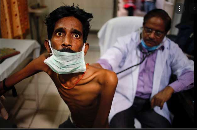 WHO Says 10.6 Million People Infected With Tuberculosis in 2021